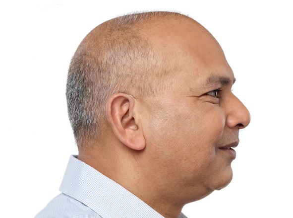 Homme chauve qui porte des appareils auditifs contours d'oreille invisibles